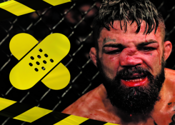 How did Jose Aldo get that scar on his face? Here is the real story behind the UFC fighter!