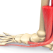 Experiencing Reed Injury? Learn How to Manage the Pain Now